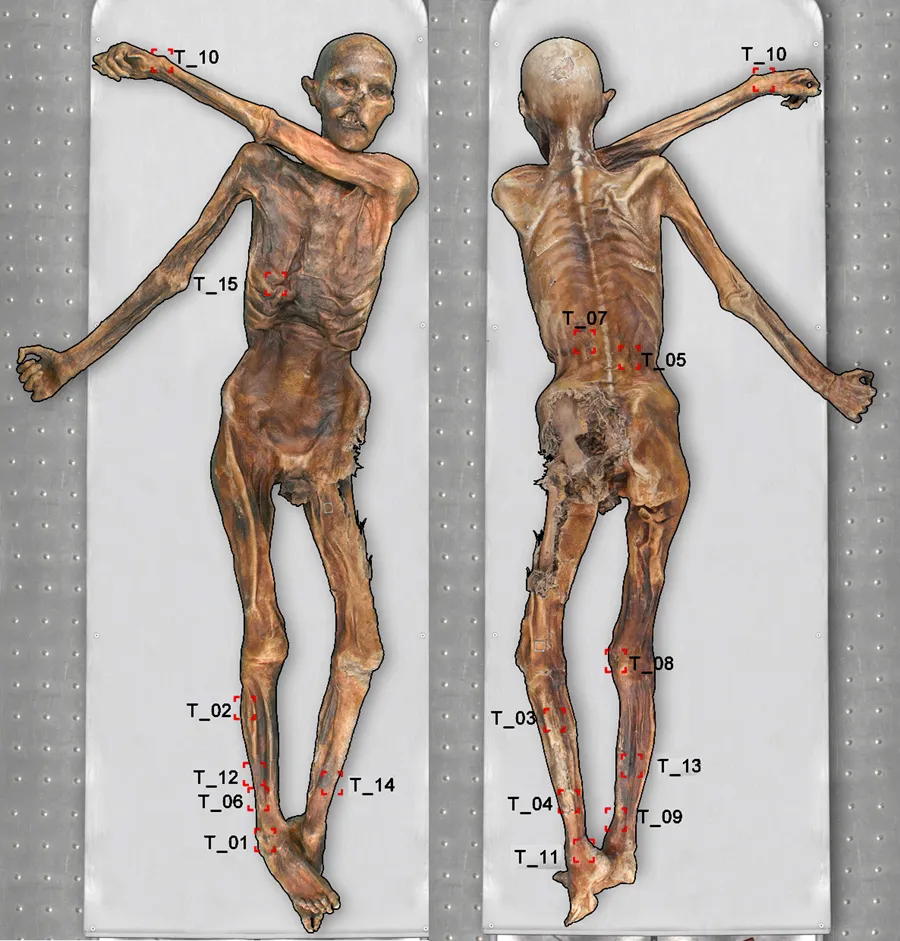 Localisation des tatouages d'Ötzi l'homme des glaces